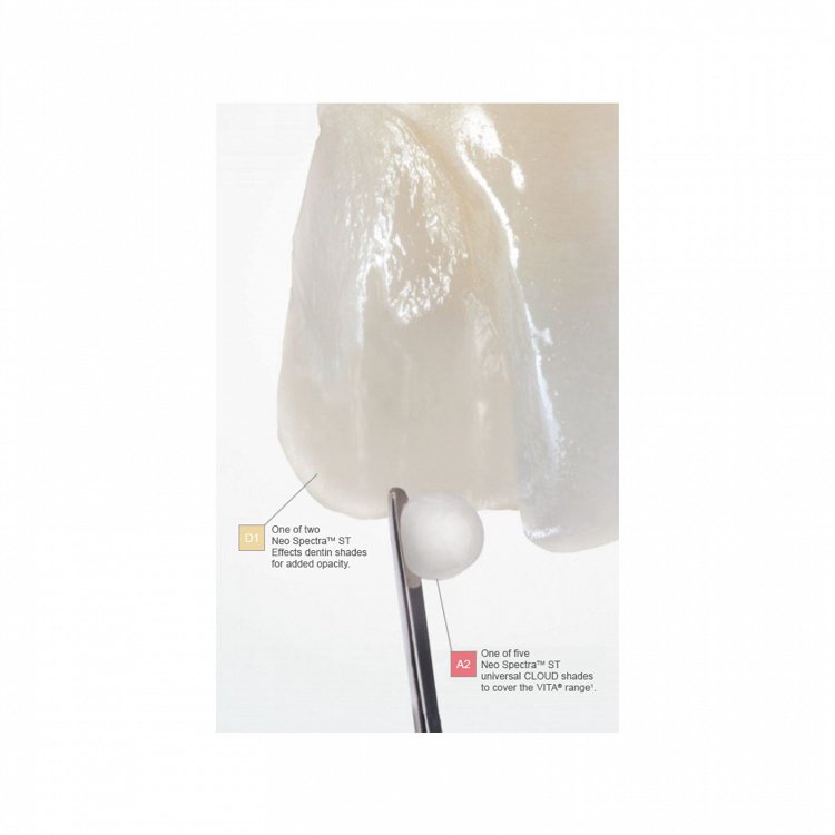 Dentsply Neo Spectra ST Intro Kit