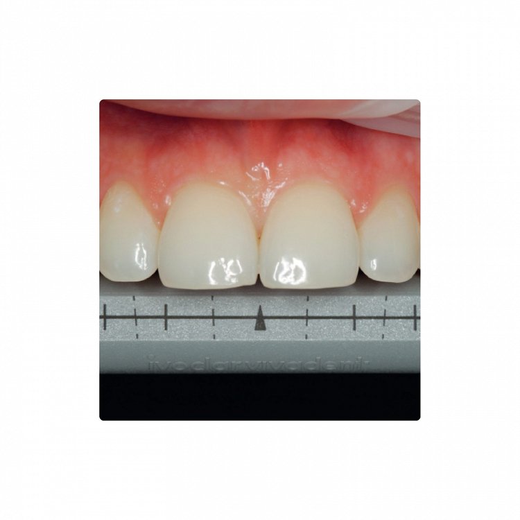 Ivoclar Optrasculpt Pad Instrument