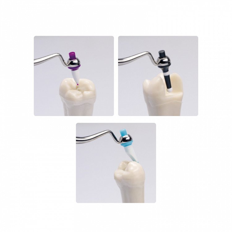 Ivoclar Μύτες Optrasculpt