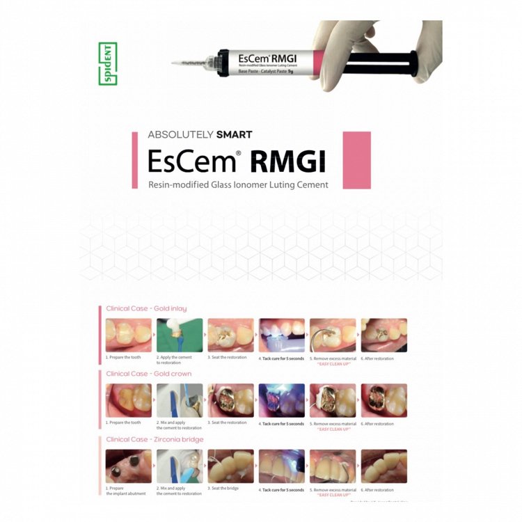 Spident EsCem RMGI