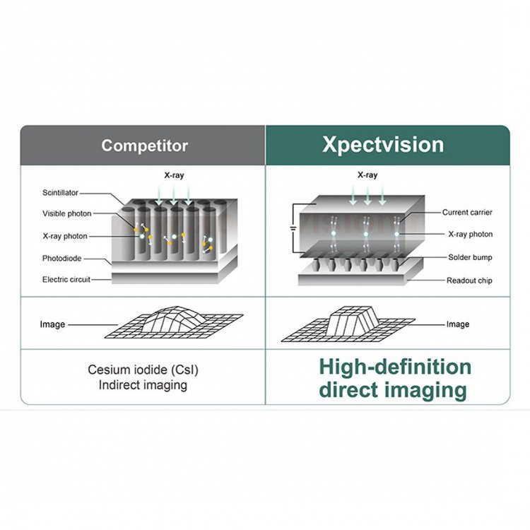 Xpect Vision Ψηφιακός Σένσορας Ακτινογραφίας