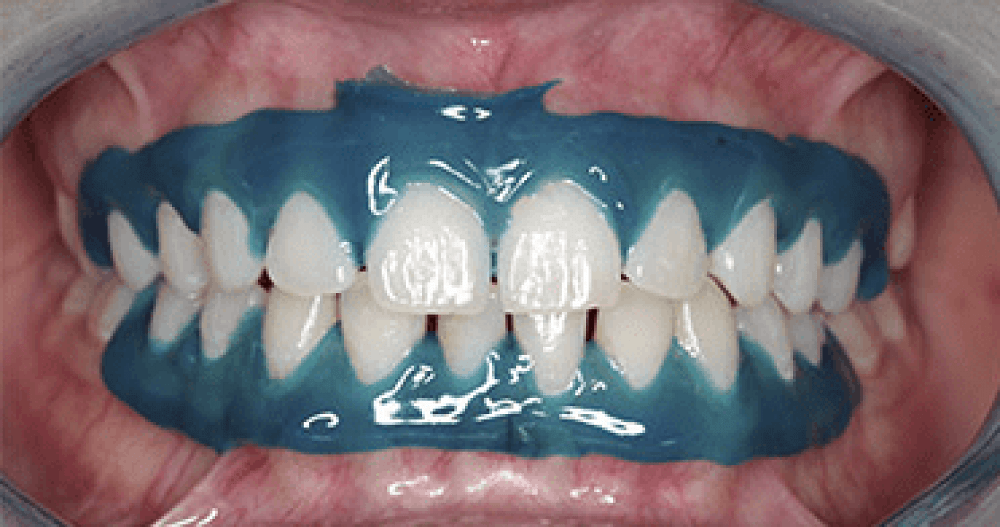 i-Dental i-Dam