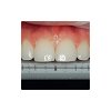 Ivoclar Optrasculpt Pad Instrument