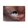 Ultradent Oraseal Kit