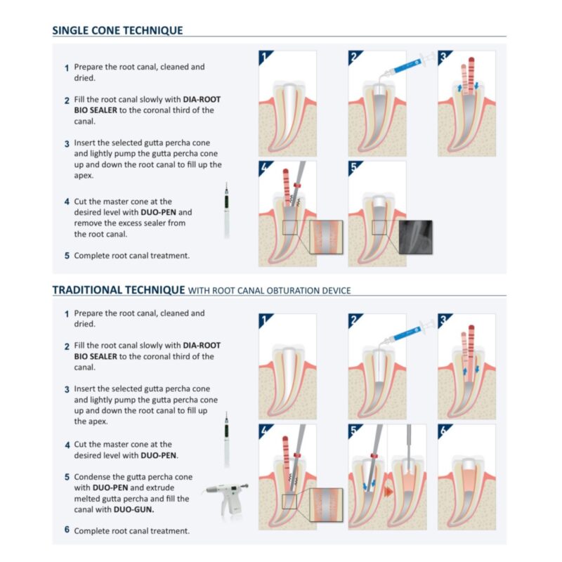 Diadent Dia-Root Bio Sealer - Filios Dental